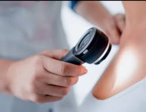 Dermatoscopy: A Modern Tool for Early Skin Disease Diagnosis