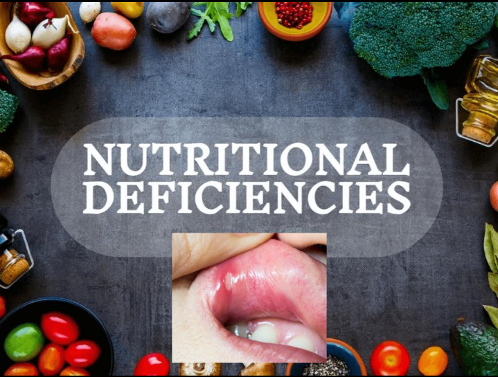 Poor Healing and Folate (Vitamin B9) Deficiency