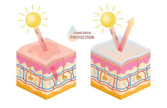 Photoprotection