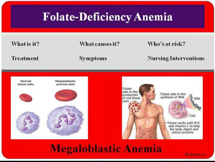 Pale Skin and Folate (Vitamin B9) Deficiency