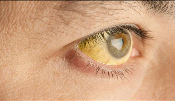 Skin Manifestations of Internal Disease: When Your Skin Reveals What’s Happening Inside